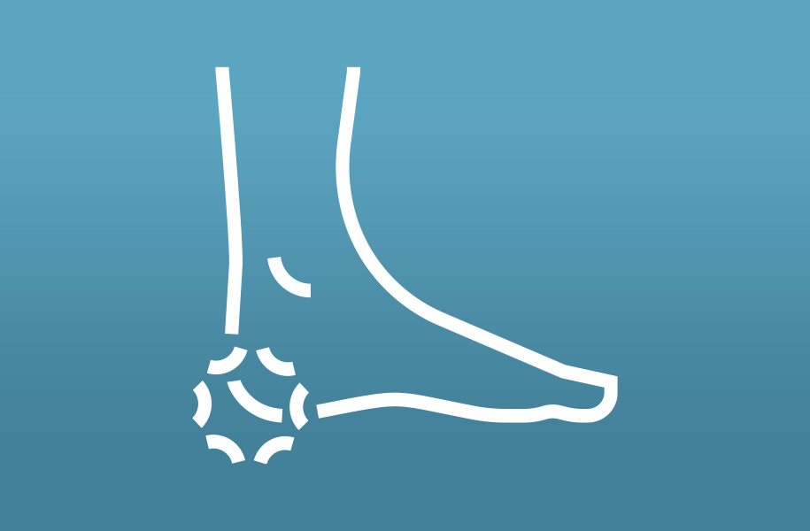An illustration of a foot with a pain marker on the heel.