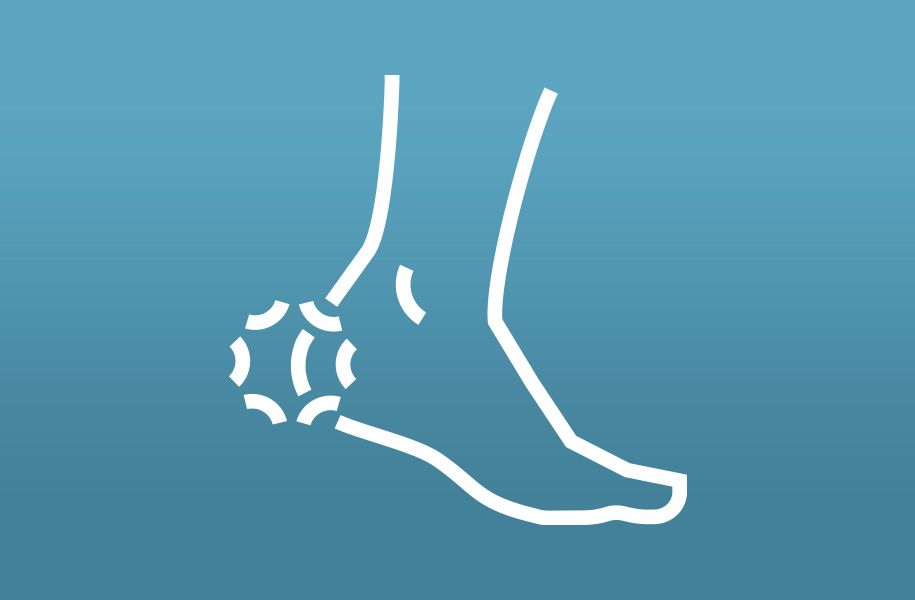 An illustration of a foot with a pain marker on the heel.