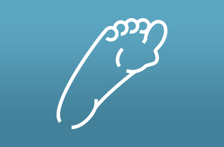 An illustration of a foot with a bunion.