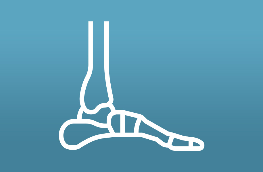 An illustration of a skeletal foot.